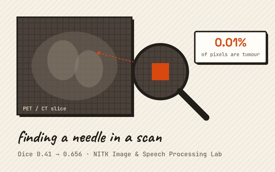 Illustration of a magnifying glass finding a tiny tumour in a scan